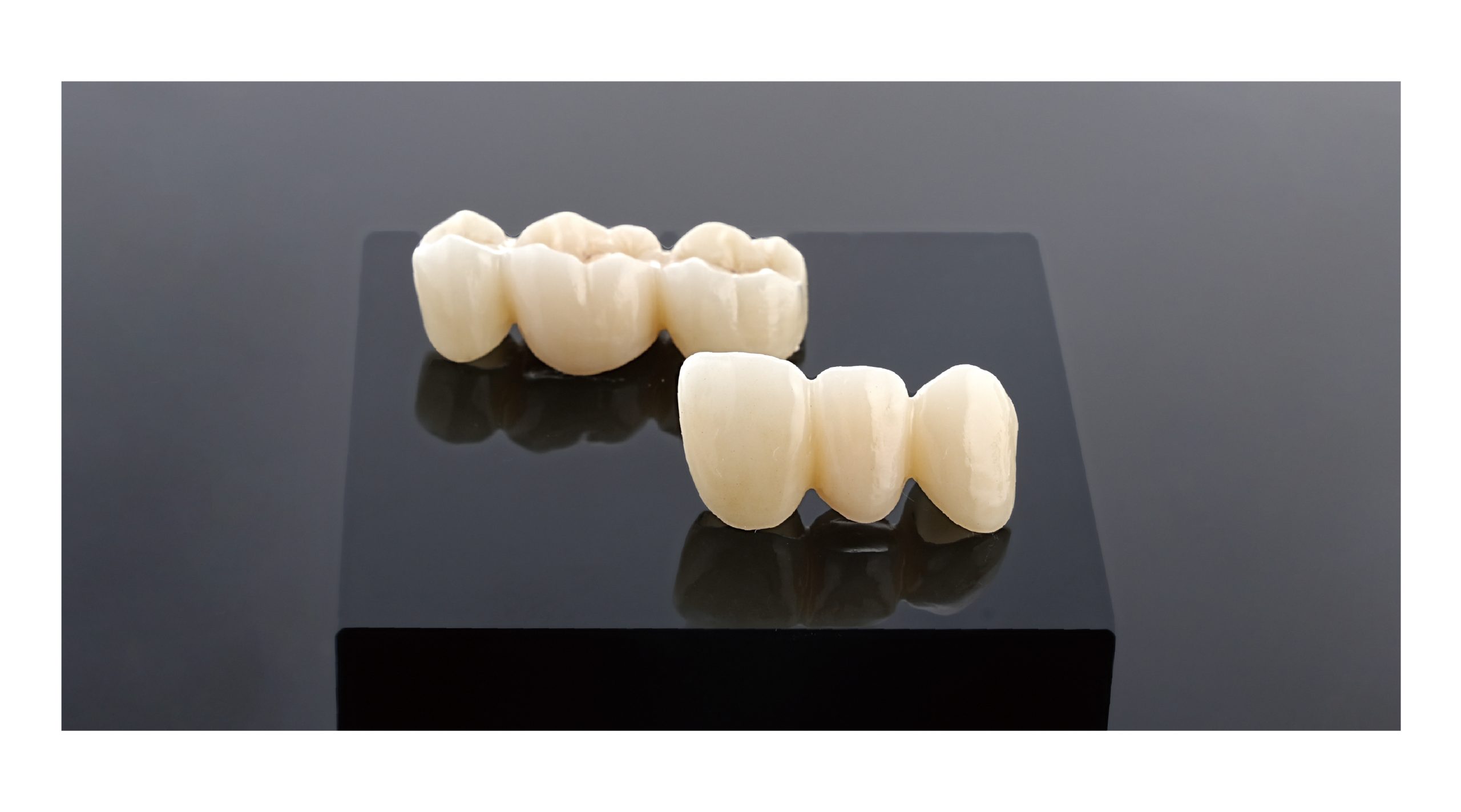Dental Restoration Clinical Case Study