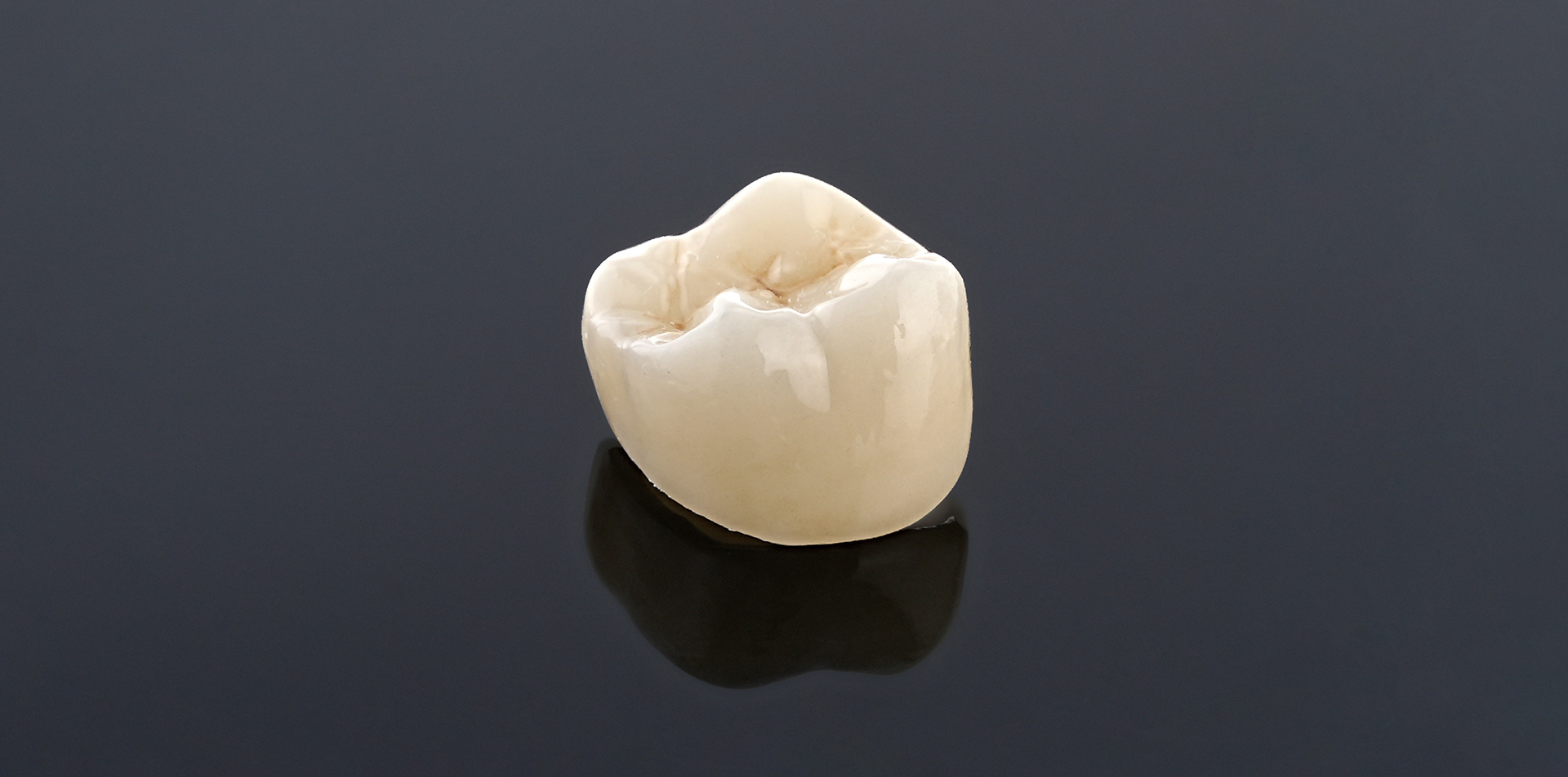 Dental Restoration Clinical Case Study
