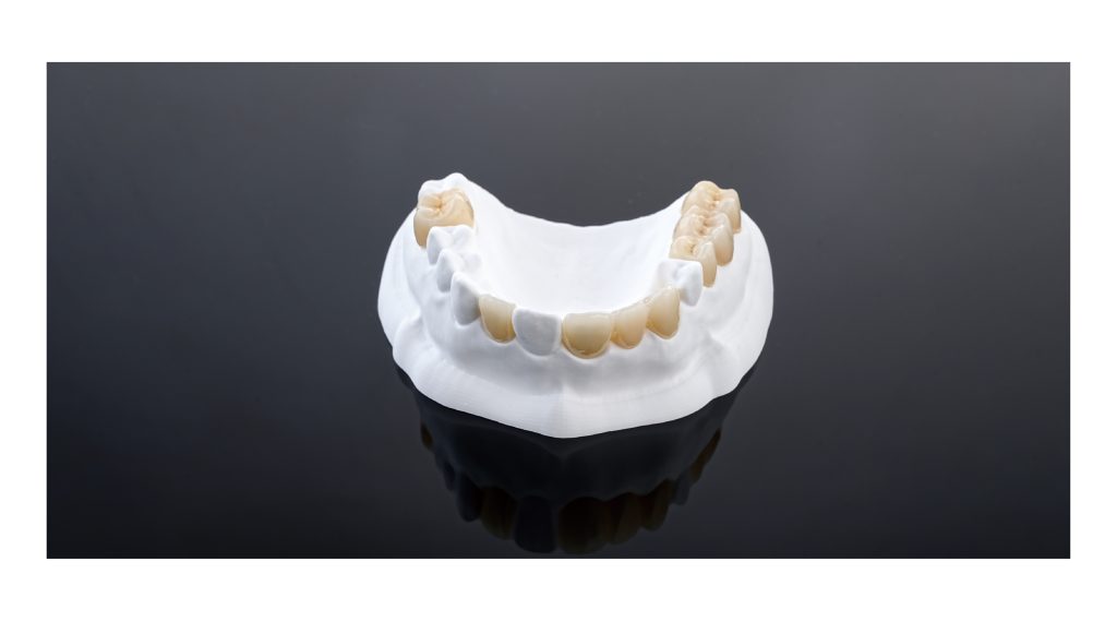 Anterior and posterior dental bridge restoration cases milled from Mammudent ST-ML multilayer zirconia blocks.