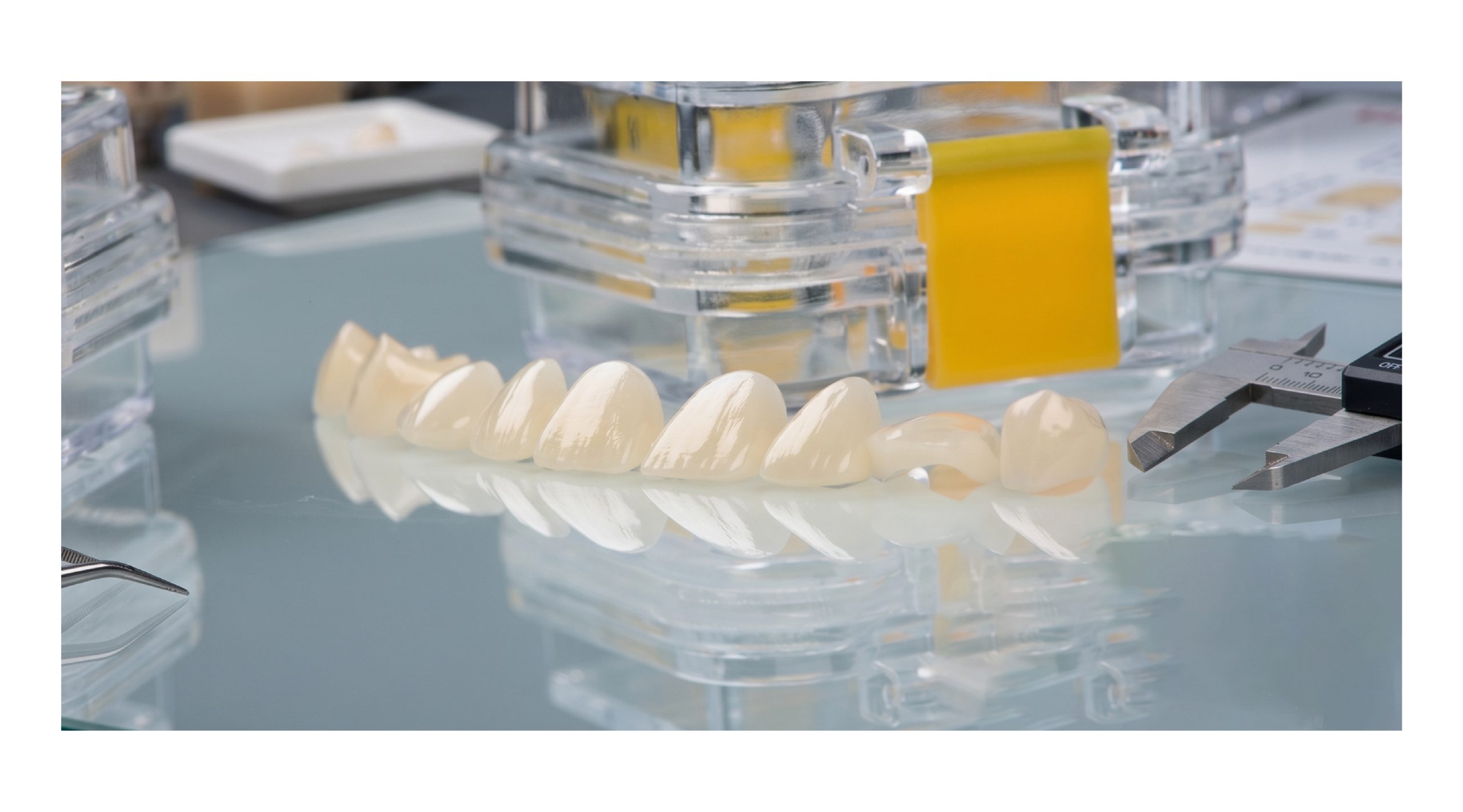 Dental Restoration Clinical Case Study