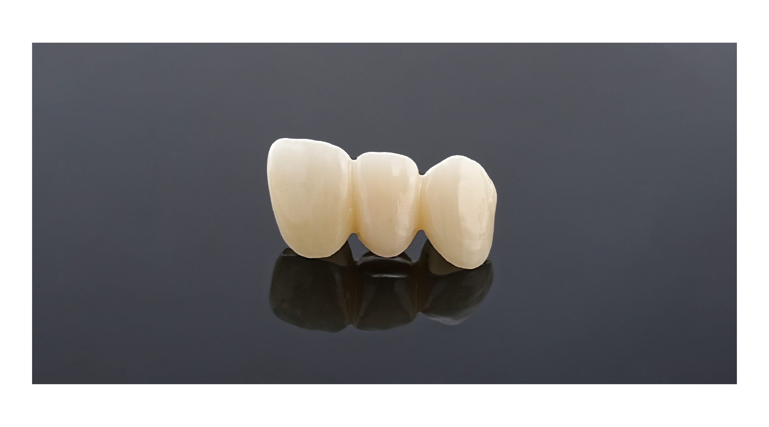 Dental Restoration Clinical Case Study